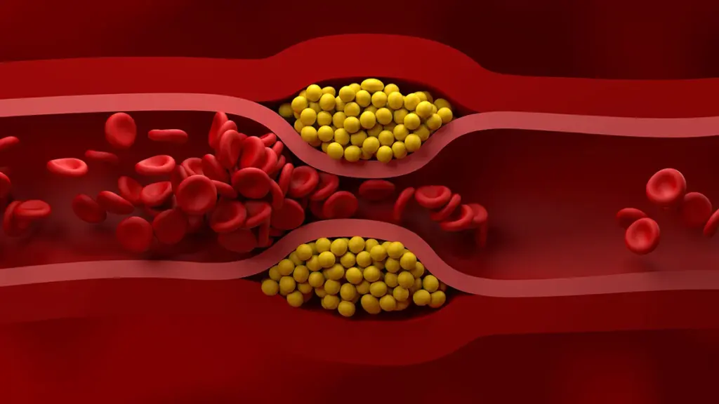 US Cardiologists Have Just Published