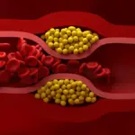 US Cardiologists Have Just Published New Guidelines For Managing Cholesterol